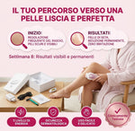 EPI 2.0 epilatore IPL ALVEO Milano