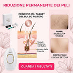 EPI 2.0 epilatore IPL ALVEO Milano