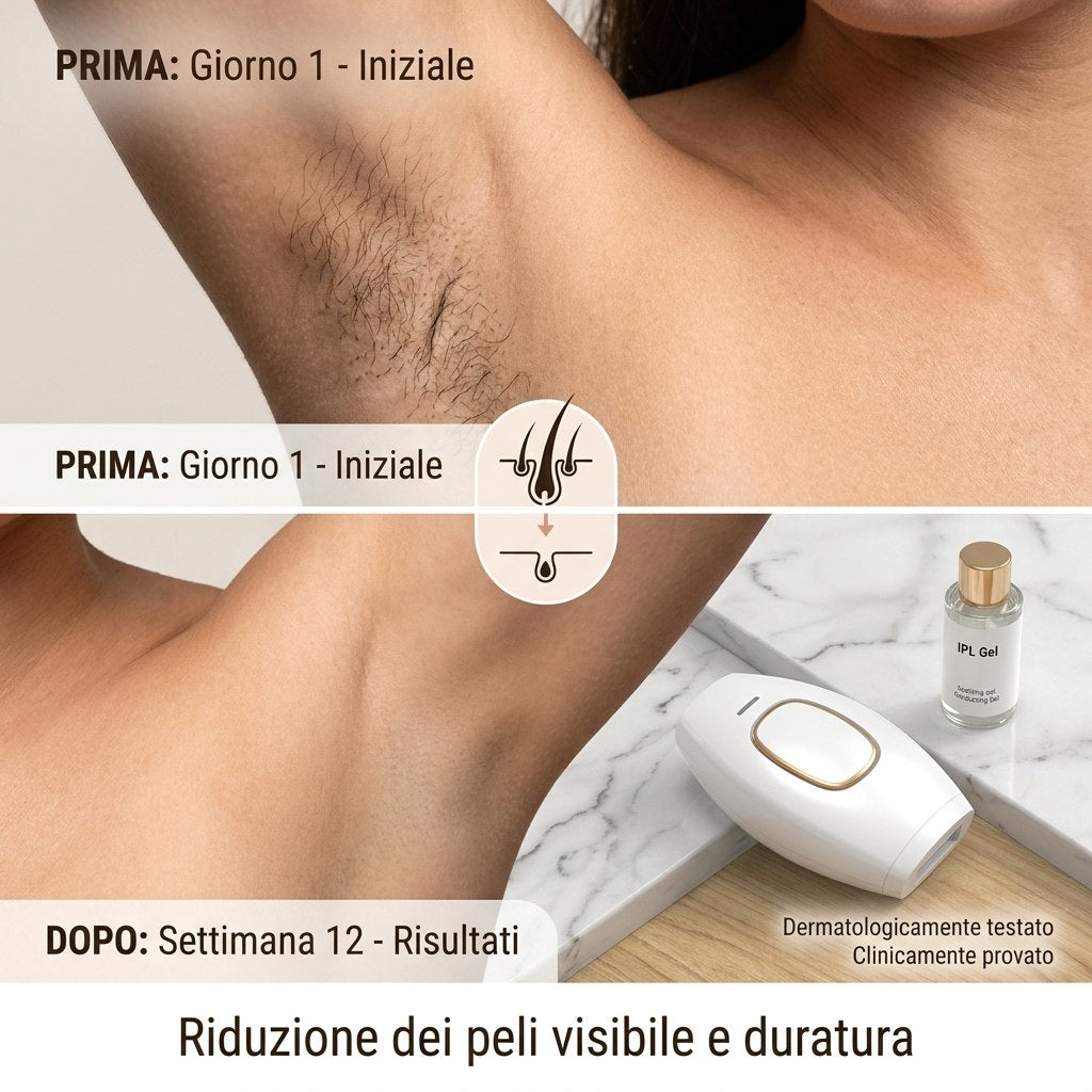 EPI 2.0 epilatore IPL ALVEO Milano