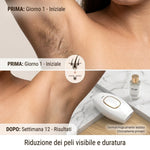 EPI 2.0 epilatore IPL ALVEO Milano